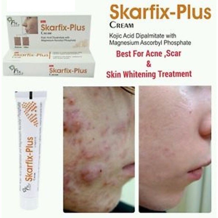 Fixderma Skarfix Plus Cream Làm Sáng Da, Giảm Sạm Nám Tàn Nhang  -15g