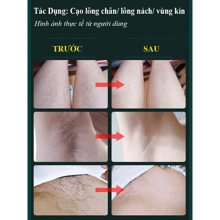 Máy Cạo Lông Đa Năng 4 trong 1 Cạo Lông Mặt, Tỉa Lông Body Vùng Kín Bikini Tỉa Lông Mày Tỉa Lông Mũi Sạc USB