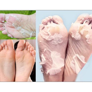 Ủ chân , ủ tẩy da chết chân