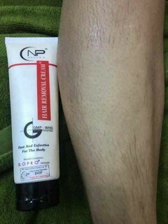 Triệt lông nelly.p( feeship)