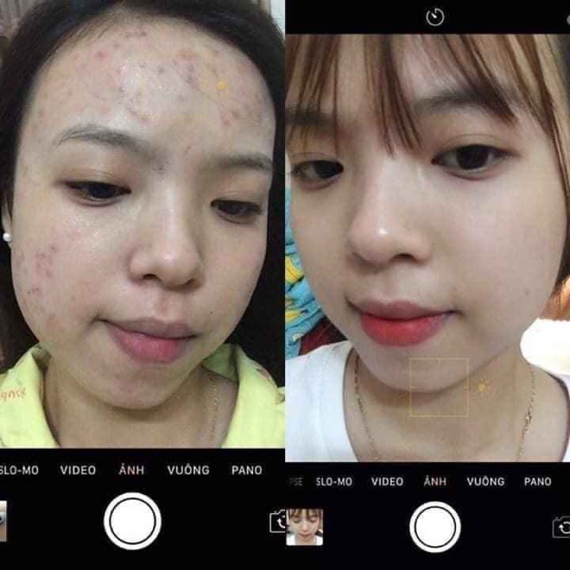 Serum đường đen Black sugar(khẳng định hiệu quả hơn mẫu caramel hồng nhé) KHÔNG HIỆU QUẢ HOÀN TIỀN | BigBuy360 - bigbuy360.vn