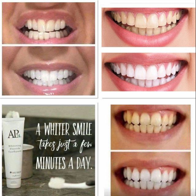 Kem đánh răng Ap24