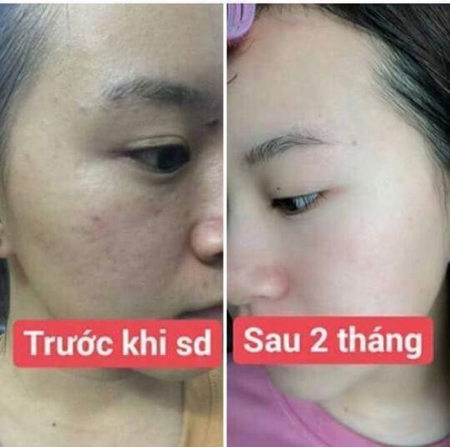 Thuốc Bắc Handmade Tái Tạo Da - Serum Giảm Mụn Thâm Rỗ - Đánh Bay Tất Cả Các Loại Mụn, Mờ Nám, Tàn Nhan | BigBuy360 - bigbuy360.vn