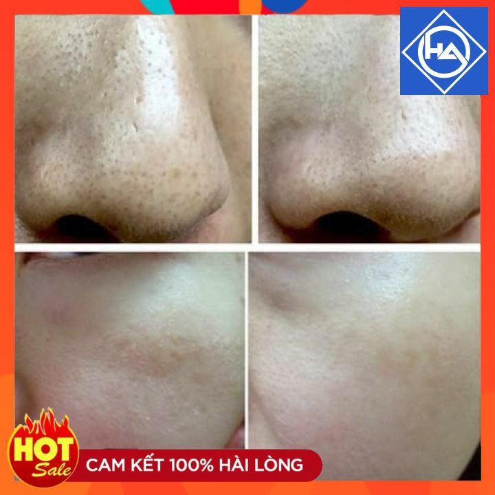 1 lọ Vi tảo sinh học Ronas Resting Peel