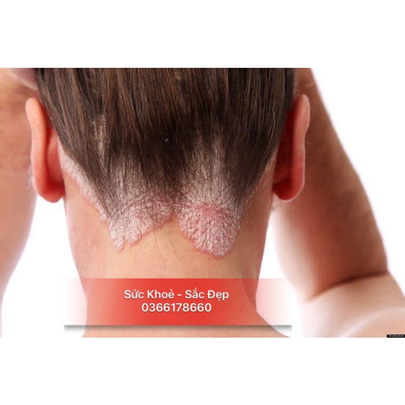 Dầu gội đầu Mintar Liquid  chai 150ml