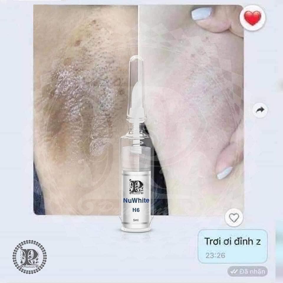 Kem làm hồng nhũ hoa MIBITI PRUDENTE NUWHITE N1 hồng môi - t.r.ị thâm - hồng bikini | BigBuy360 - bigbuy360.vn