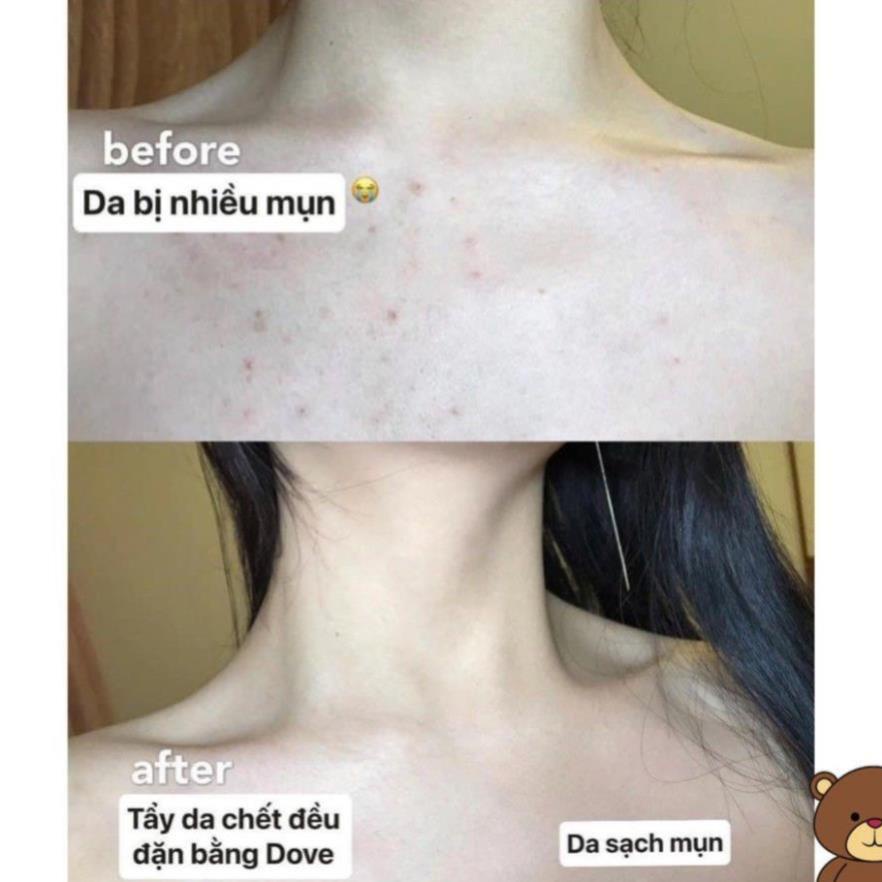 [HÀNG HOT] Tẩy da chết body DOVE giúp da mịn màng chiết xuất từ thiên nhiên hũ 50g | BigBuy360 - bigbuy360.vn