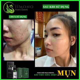 Tinh chất mụn IIMONO 20ml serum
