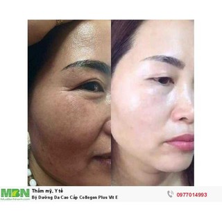 Bộ kem cao cấp colagen Plus Vit e [kem ngày đêm và xà phòng]