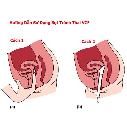 VCF màng film tránh thai hộp 3 miếng