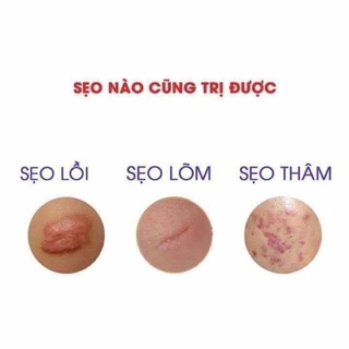 Kem sẹo Collagen