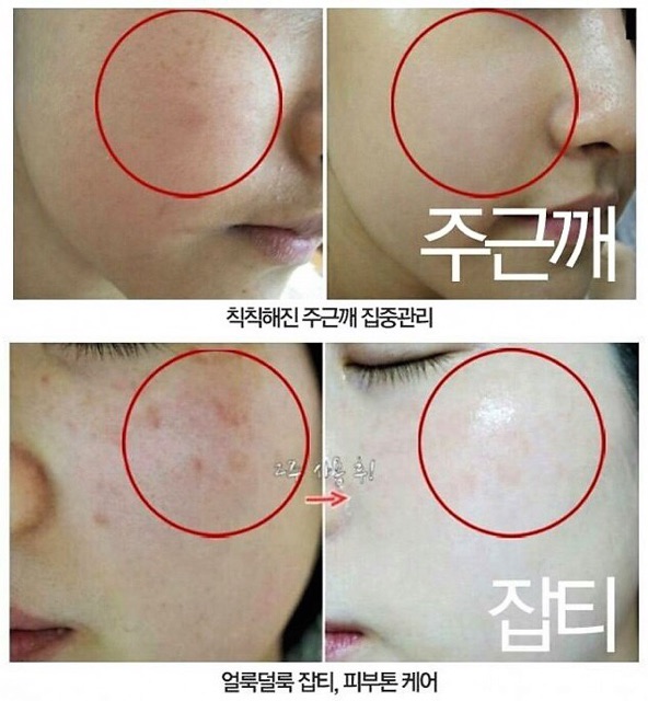 Kem dưỡng trắng giúp ngừa Nám,Tàn Nhang Melasma-X 3D Whitening Clinic Cream | BigBuy360 - bigbuy360.vn