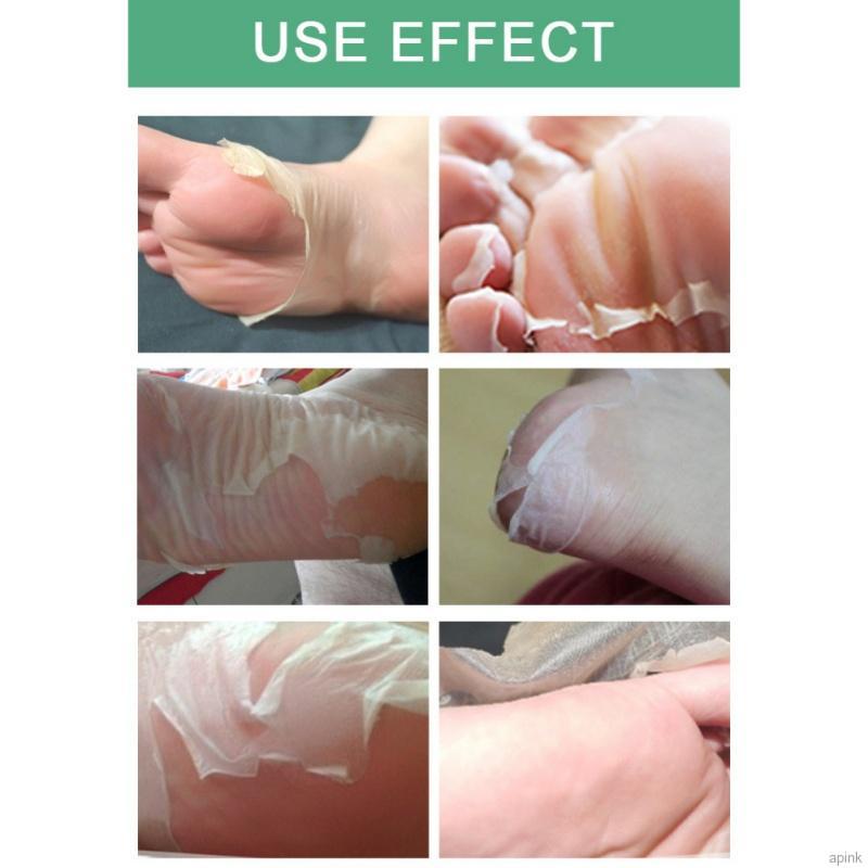 (Hàng Mới Về) Mặt Nạ Chân Tẩy Tế Bào Chết Chăm Sóc Da Chân