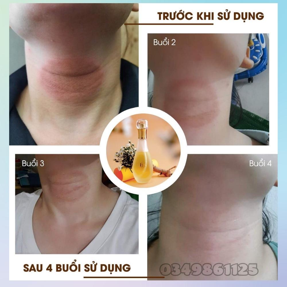 Nước thần Revitalizing E&G Beauty Hàn Quốc phục hồi,tái tạo,hồi sinh làn da - 9ml