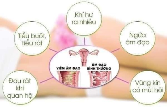 [CHUẨN HÀN QUỐC] DUNG DỊCH VỆ SINH NAM NỮ HÀN QUỐC[BẢO HÀNH 30 NGÀY][THIÊN NHIÊN][FREESHIP