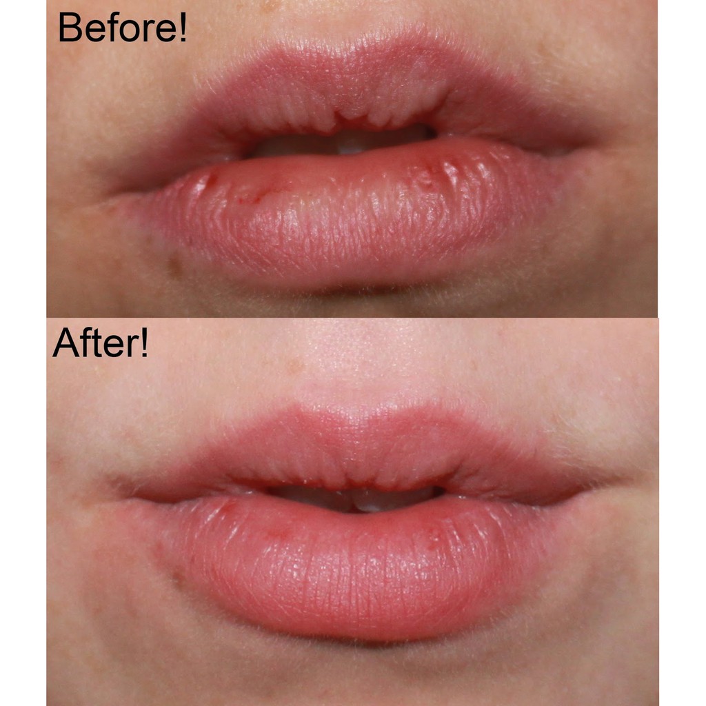 Tẩy da chết môi beauty treats lip scrub - Mỹ | BigBuy360 - bigbuy360.vn