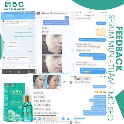 Tinh chất ngăn ngừa, giảm mụn thâm Collagen Mộc Love Skin White 10ml