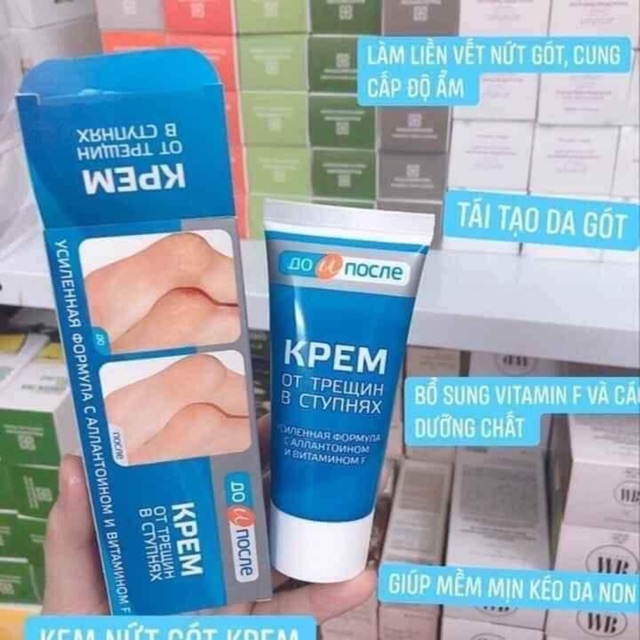 Kem trị nứt gót chân Kpem Apteka Nga