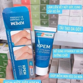 Kem trị nứt gót chân Kpem Apteka Nga