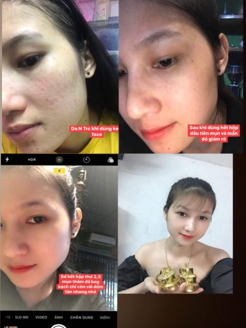 combo 3 Kem face candy  [ tặng kèm quà] | BigBuy360 - bigbuy360.vn