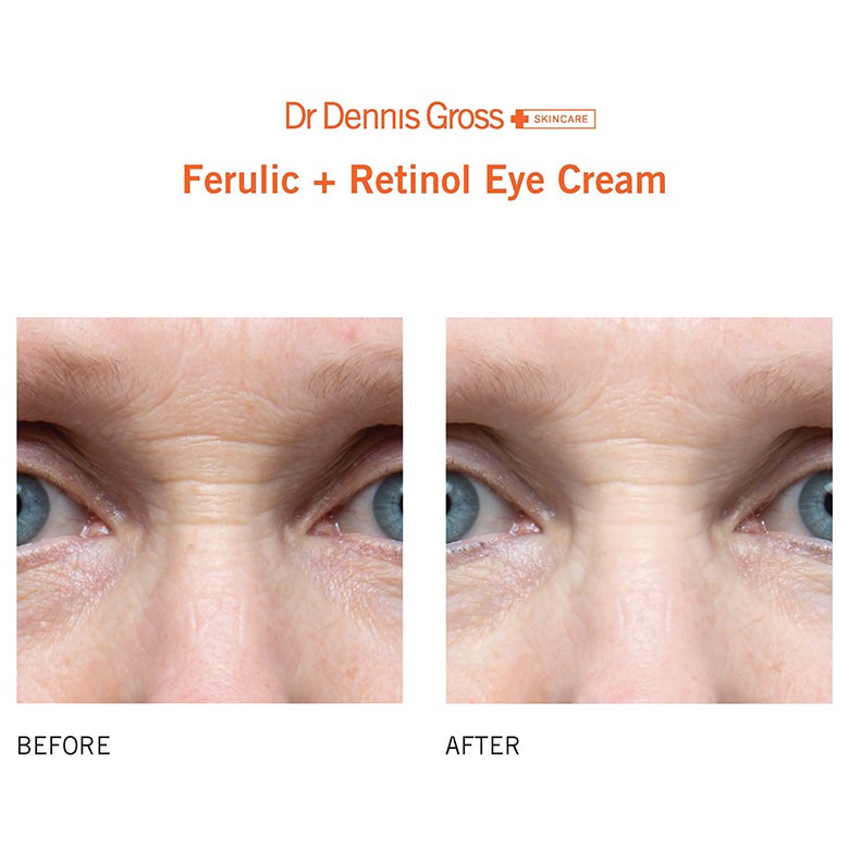 Kem mắt chống lão hóa Dr Dennis Gross Ferulic Retinol Eye Cream | BigBuy360 - bigbuy360.vn