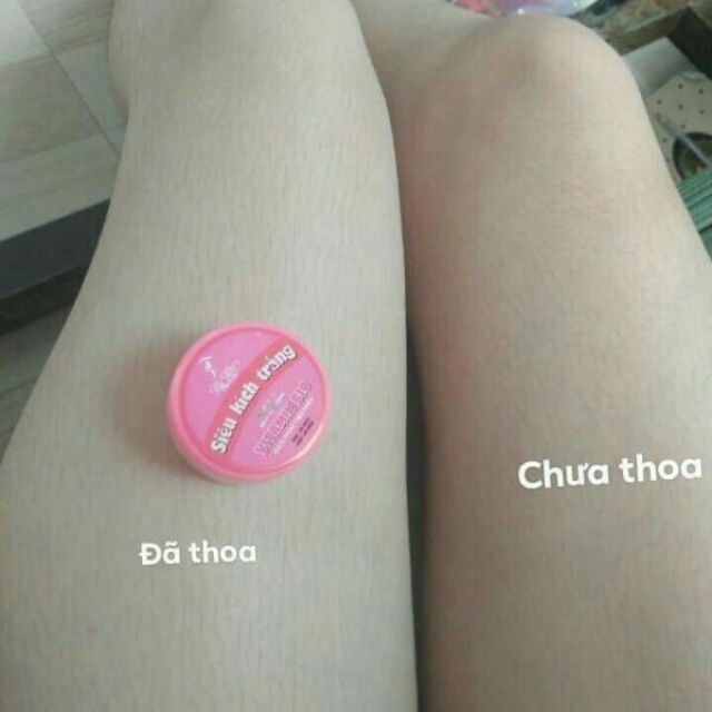 Kích trắng vitamin b10