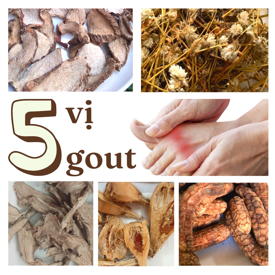 Combo 5 Vị Hỗ Trợ Bệnh Gút, Thang Cho Người Bệnh Gout (Củ Ráy, Chuối Rừng, Dứa Dại, Nở Ngày Đất, Cát Lồi)
