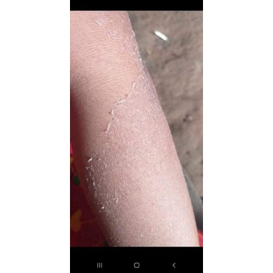 Kem bong da tái tạo DH White Vip hủ 100k ❤ freeship ❤