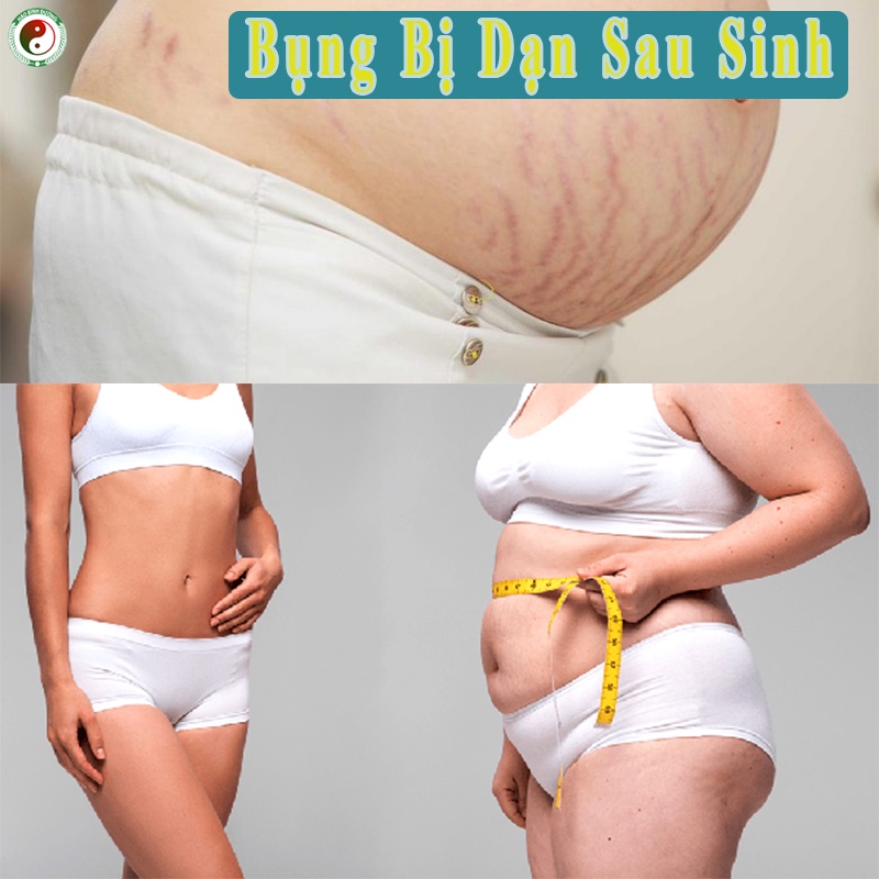 Cốt Rượu Gừng Nghệ Gấc Hạ Thổ Sau Sinh Giúp Giúp Bụng Đẹp Không Còn Bị Rạn Sau Sinh | BigBuy360 - bigbuy360.vn