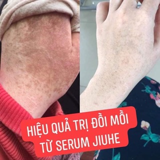SIRUM JIUHE VUA TRỊ THÂM