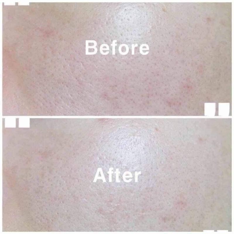 Nước hoa hồng toner Rau má Centella skin1004