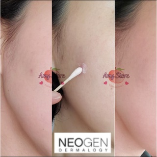 Chấm mụn cấp tốc Neogen A-clear aid soothing pink eraser