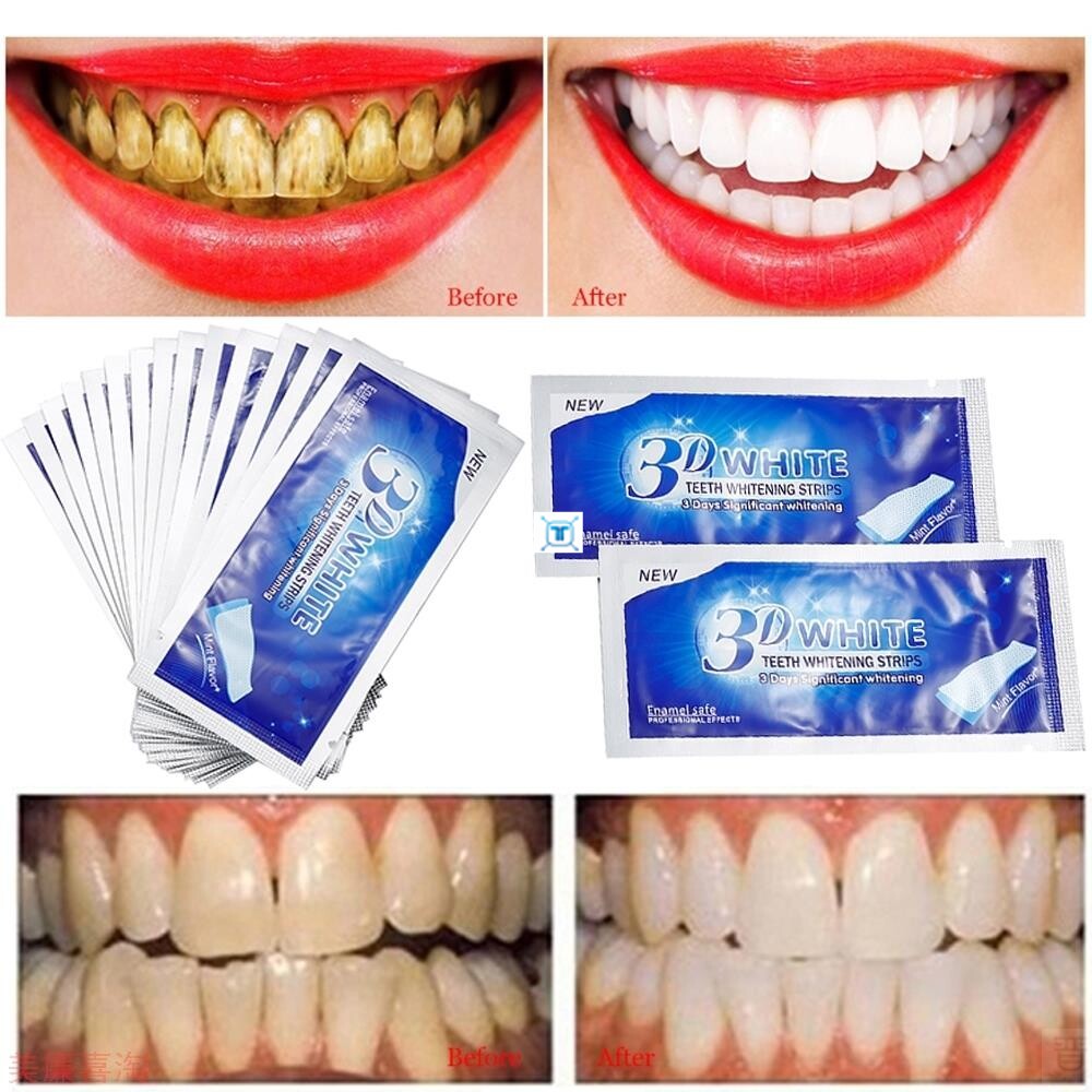 Miếng dán trắng răng 3D White Teeth Whitening Strip làm trắng răng nhanh chóng tiện lợi dễ sử dụng 1 hộp 7 miếng