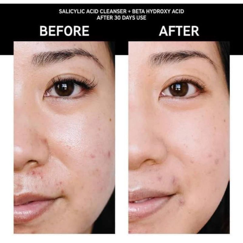 ĐỦ BILL_ SỮA RỬA MẶT BHA SALICYLIC ACID CLEANSER THE INKEY LIST 100ML