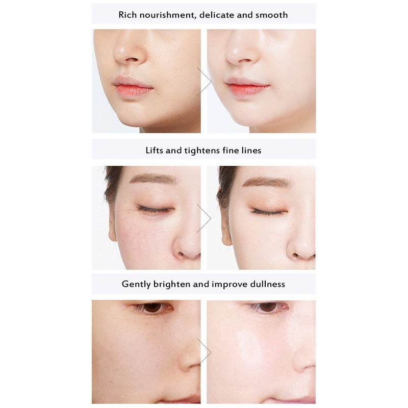 Bộ 30 Viên Huyết Thanh Dưỡng Ẩm Chống Lão Hóa Loại Bỏ Đốm Đen Làm Trắng Da Mặt