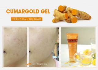 Tinh nghệ CumarGold Gel