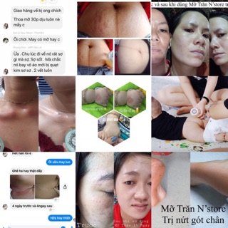 Mỡ trăn nguyên chất 100%