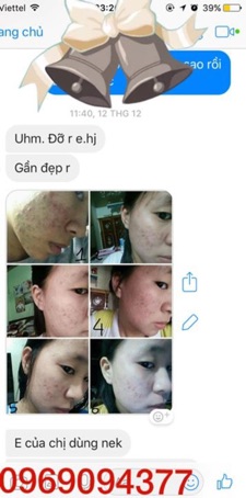 tái tạo da handmade THT
