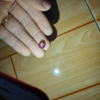 Ruby sao phi tự nhiên