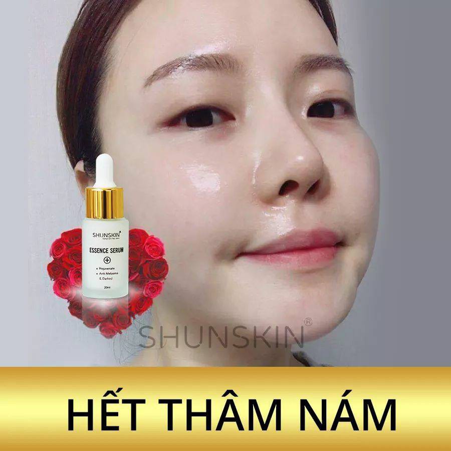 SẠCH CHÂN NÁM TẬN GỐC DA TRẮNG HỒNG MỊN MƯỚT