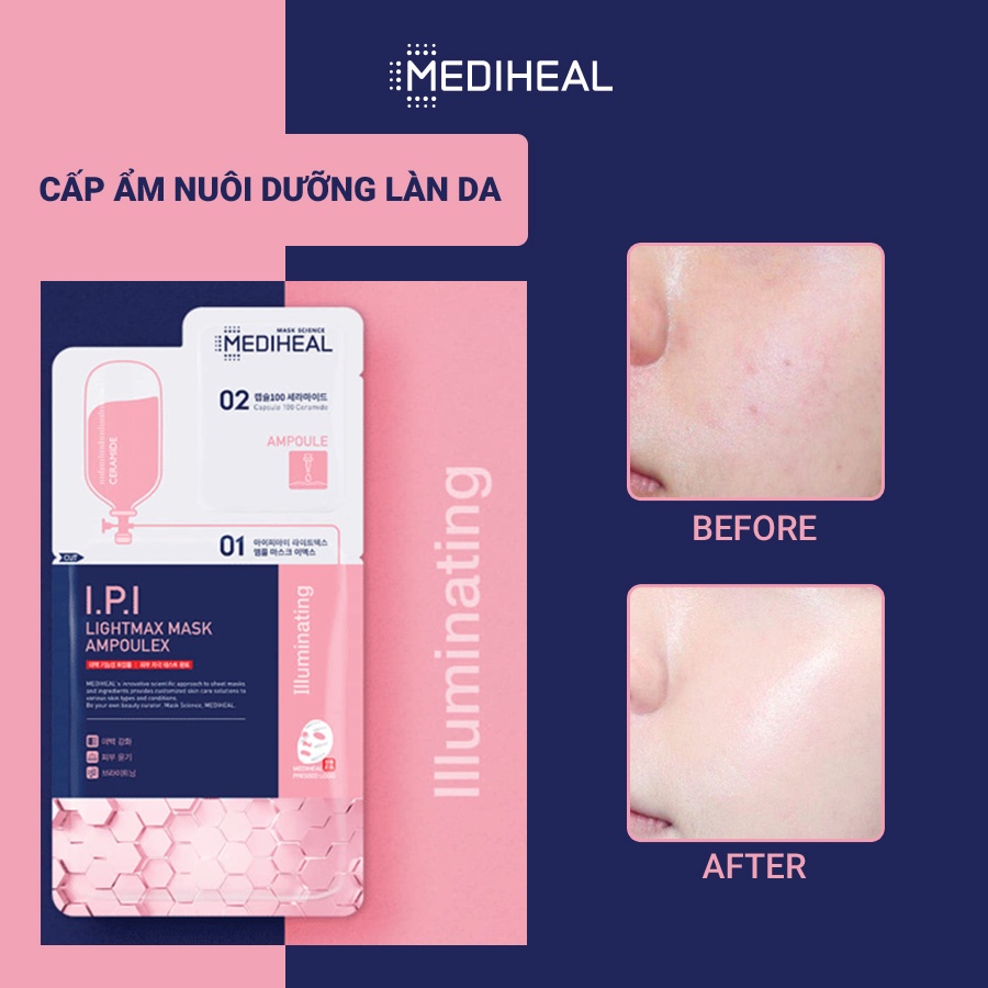 Mặt Nạ Mediheal Siêu Dưỡng Trắng Phiên Bản 2 Bước I.P.I Lightmax Mask Ampoulex 30ML [K66]