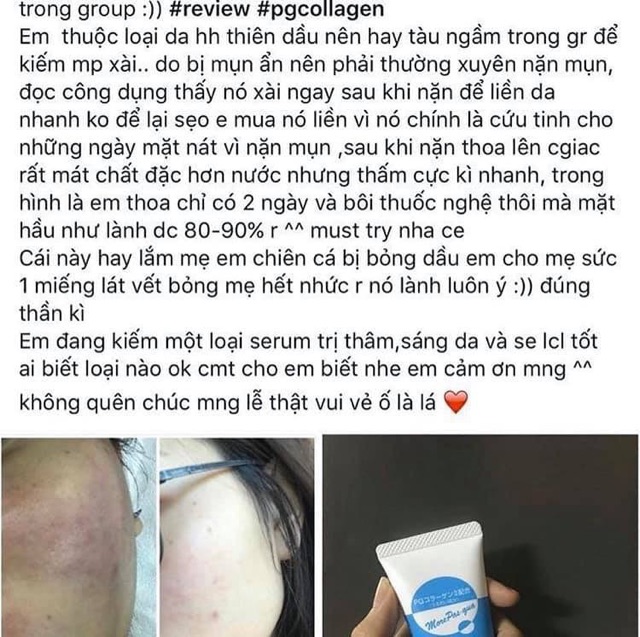 GEL PG COLLAGEN TÁI TẠO DA (MẪU MỚI 80G) | BigBuy360 - bigbuy360.vn