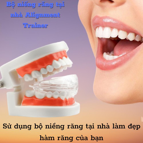 Hàm duy trì dành cho người sau niềng răng, tháo niềng răng cần đeo niềng duy trì để ổn định răng