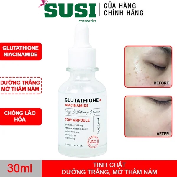 Huyết Thanh Truyền Trắng Hỗ Trợ Giảm Nám Angel’s Liquid GLUTATHIONE + NIACINAMIDE V-AMPOULE