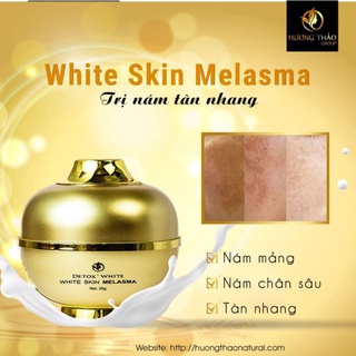 Kem ngừa nám, tàn nhang - White Skin Melasma