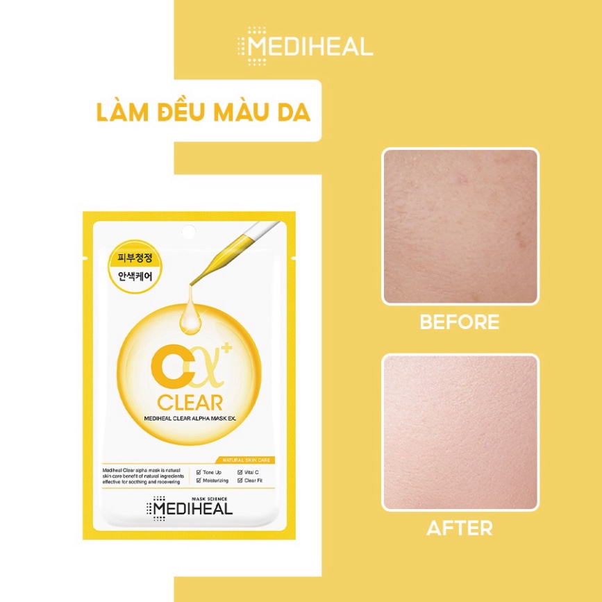 Mặt Nạ Giúp Làm Sạch, Sáng Mịn Da Mediheal Clear Alpha Mask EX 23ml