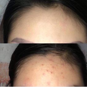 Serum đường đen Black sugar ♥️ Black sugar Nhật Bản chính hãng (PHIÊN BẢN ĐEN NGỪA MỤN TỐT HƠN) ko vỏ hộp | BigBuy360 - bigbuy360.vn