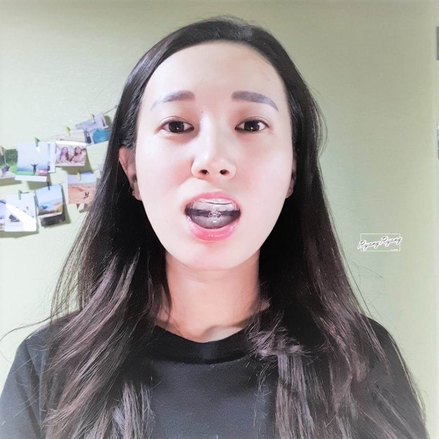 Máng/khay silicon tẩy trăng răng Dr. Hong Magic Mouth Piece