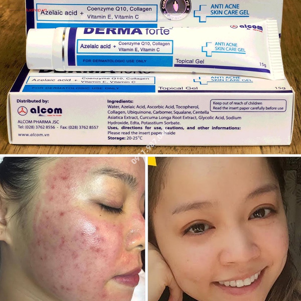 Derma Forte Kem Giảm Mụn Loại Bỏ Mụn Thâm, Mụn Trứng Cá, Làm Mờ Sẹo, Dưỡng Da