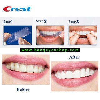 Miếng dán trắng răng Crest 3D Whitestrips Professional Effects - Gói lẻ